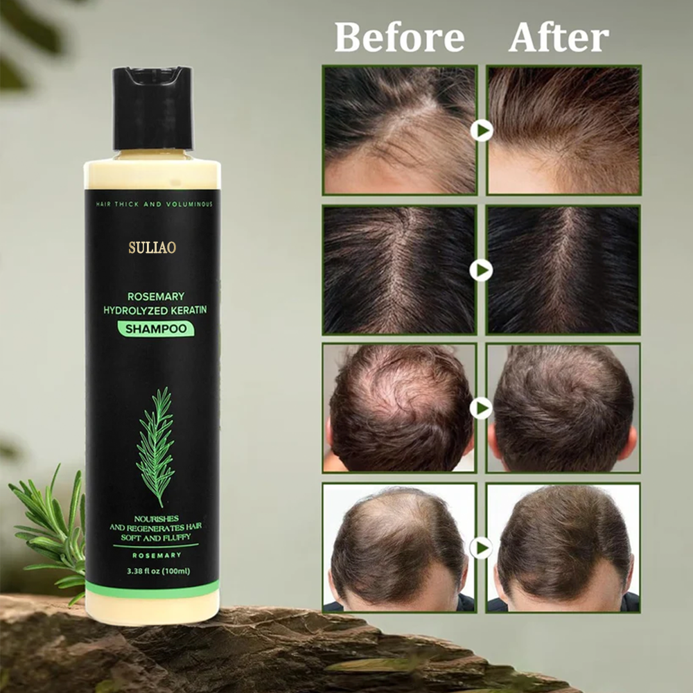 🔥LAST DAY 50% OFF - 🌿Suliao® Organic Rosemary Hair Growth Shampoo