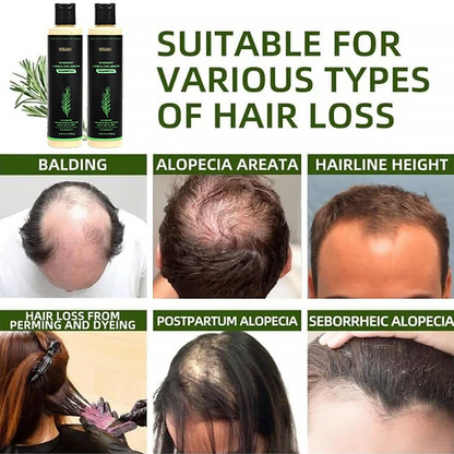 🔥LAST DAY 50% OFF - 🌿Suliao® Organic Rosemary Hair Growth Shampoo