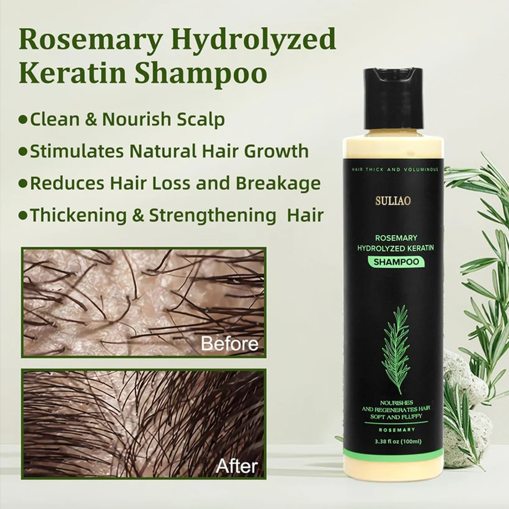 🔥LAST DAY 50% OFF - 🌿Suliao® Organic Rosemary Hair Growth Shampoo
