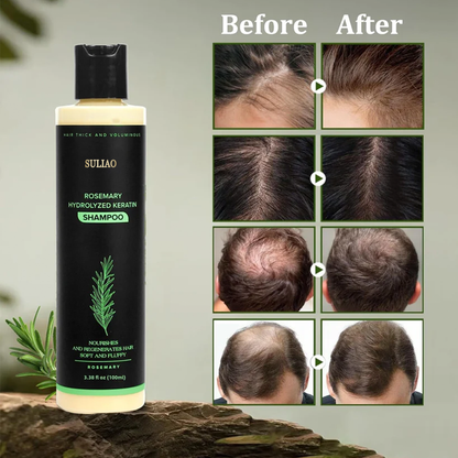 🔥LAST DAY 50% OFF - 🌿Suliao® Organic Rosemary Hair Growth Shampoo