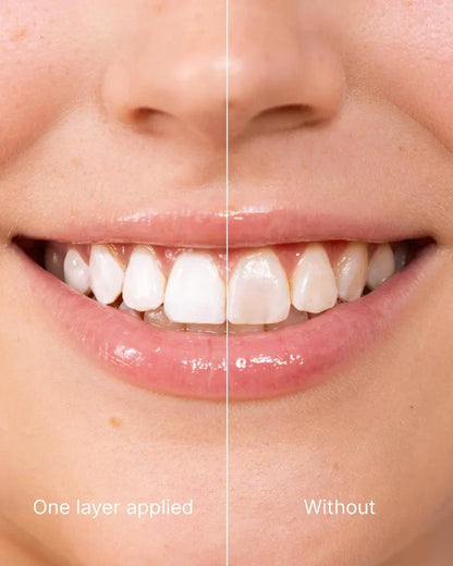 Natravor™ Tooth Polish - Instant Clean Smile