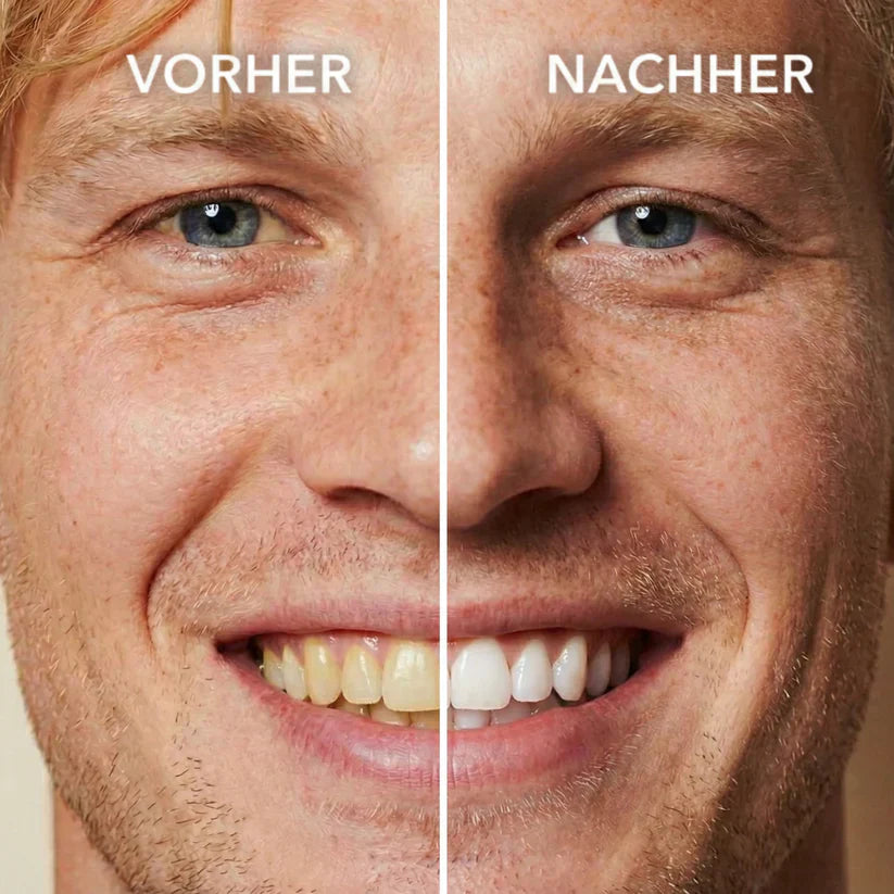Natravor™ Tooth Polish - Instant Clean Smile