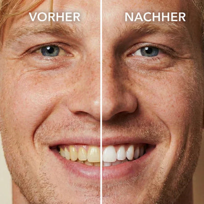 Natravor™ Tooth Polish - Instant Clean Smile