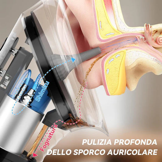 Ear Cleaner – Easy At-Home Earwax Removal System