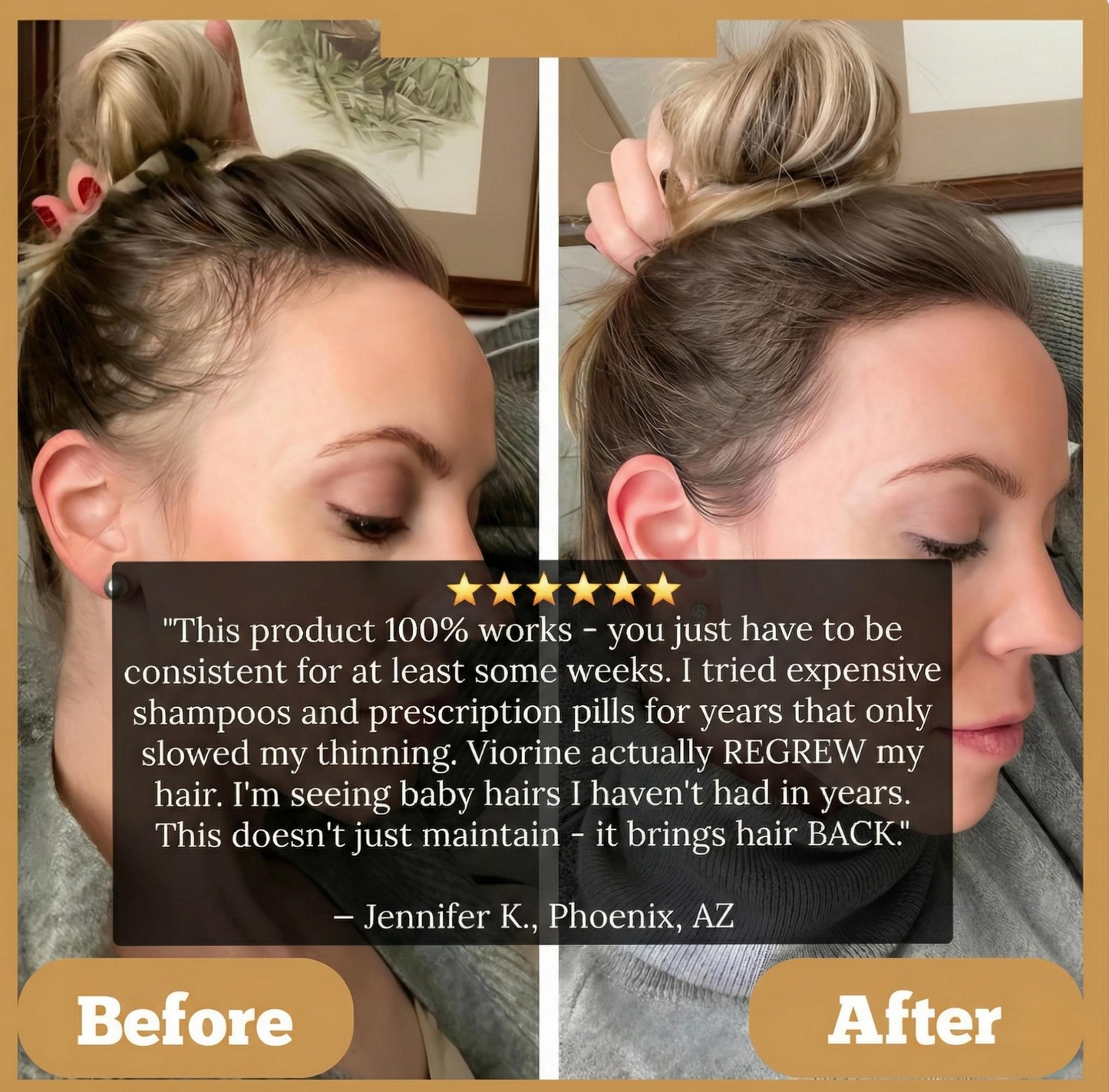 Qvelifechoose Batana Hair Oil