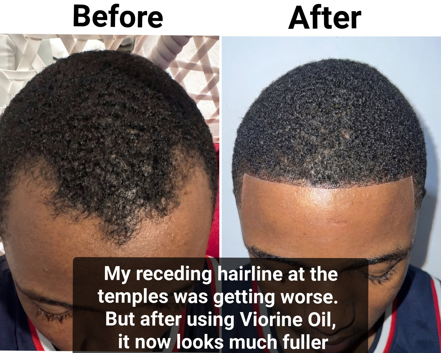 Qvelifechoose Batana Hair Oil